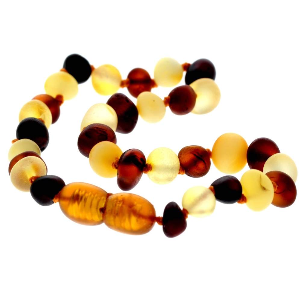 Beautiful RAW Baroque Bracelets & Anklets in Cognac & Mix colours - Various Sizes - BRAW